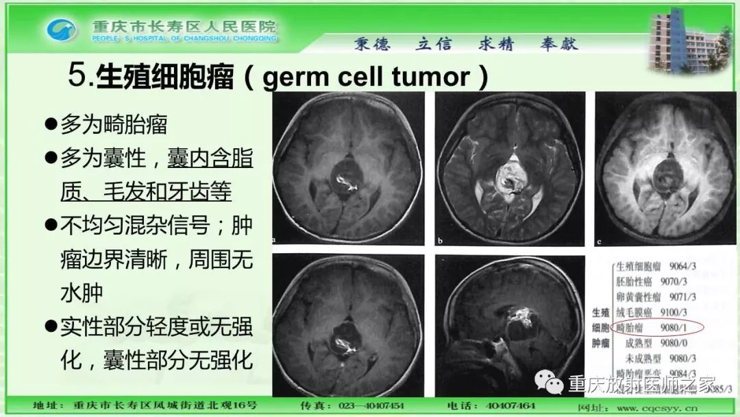 影像PPT - 【PPT】脑实质内囊性病变的MR诊断-35