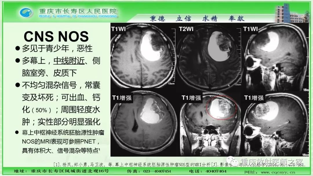 影像PPT - 【PPT】脑实质内囊性病变的MR诊断-38