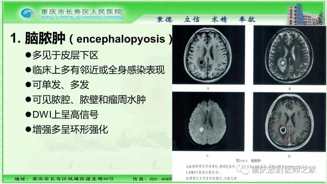 影像PPT - 【PPT】脑实质内囊性病变的MR诊断-45