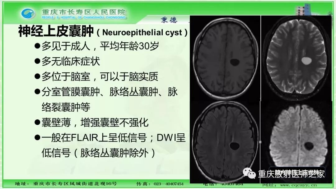 影像PPT - 【PPT】脑实质内囊性病变的MR诊断-51