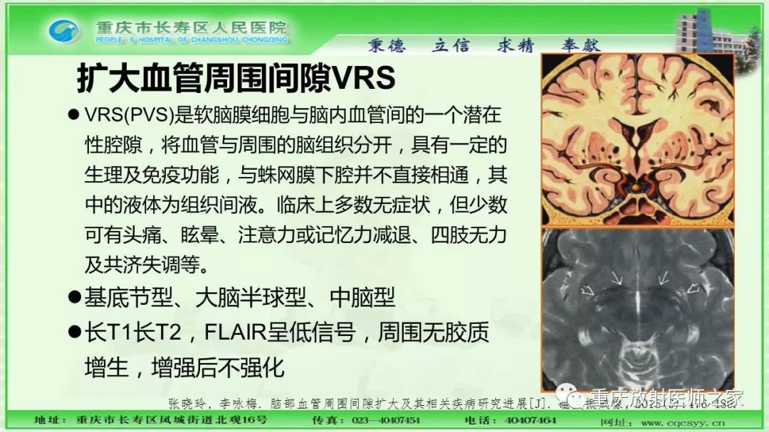 影像PPT - 【PPT】脑实质内囊性病变的MR诊断-53