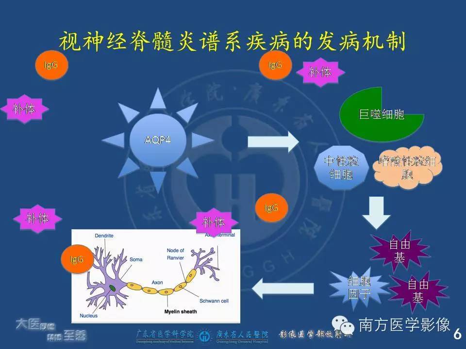 影像PPT - 【PPT】视神经脊髓炎谱系疾病的MRI特点-6