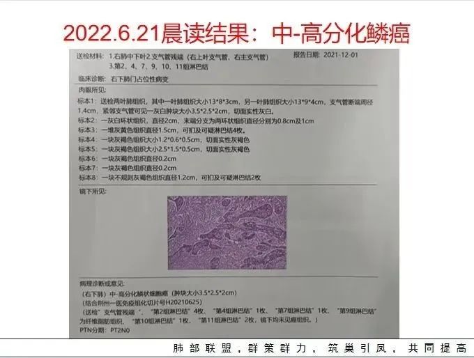 影像PPT - 【病例】管腔内病变1例CT诊断思路及易忽视的问题-33