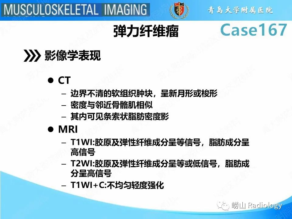 影像PPT - 【PPT】背部弹力纤维瘤-14