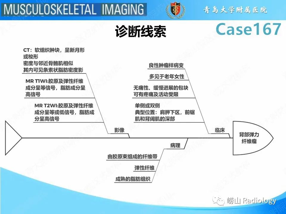 影像PPT - 【PPT】背部弹力纤维瘤-21