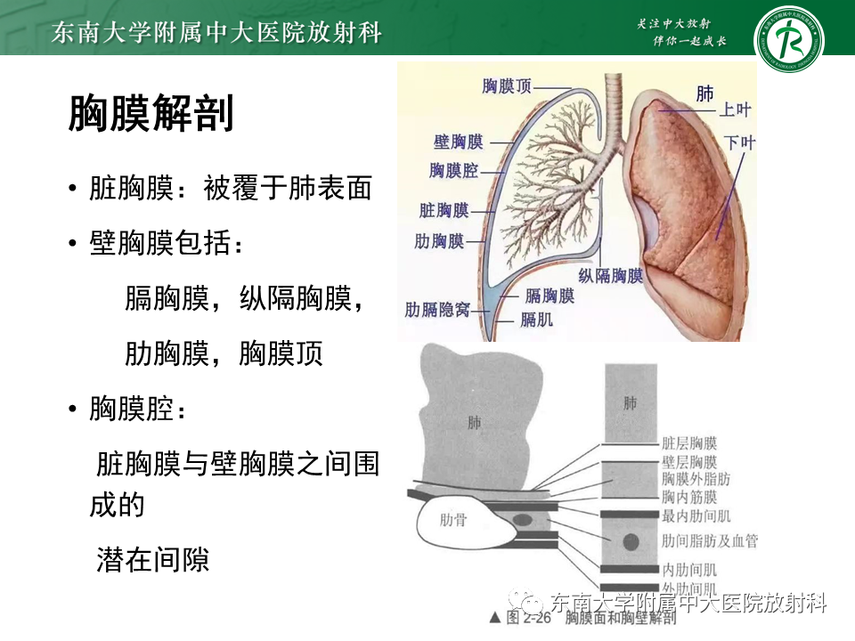 影像PPT - 【PPT】胸部孤立性纤维性肿瘤-7 影像PPT - 【PPT】胸部孤立性纤维性肿瘤-7