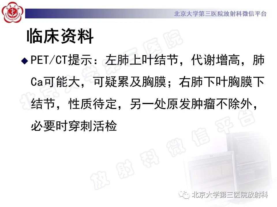 影像PPT - 【PPT】细支气管腺瘤-9