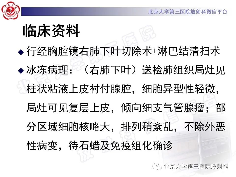 影像PPT - 【PPT】细支气管腺瘤-10