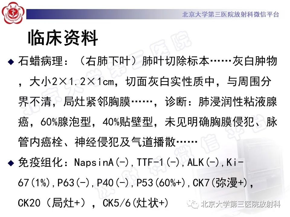 影像PPT - 【PPT】细支气管腺瘤-11