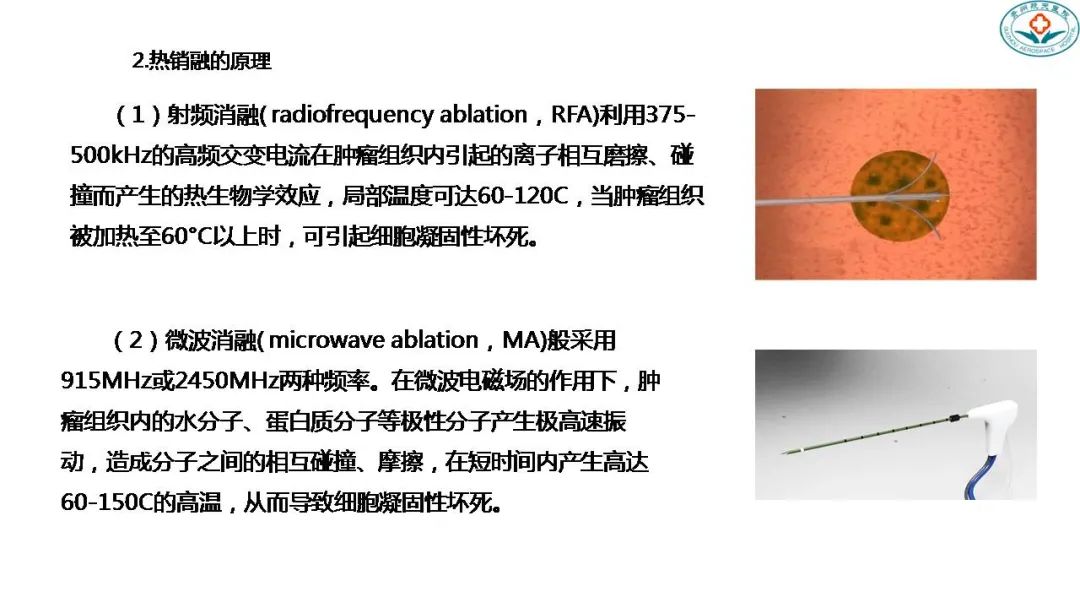 影像PPT - 肺结节的评估手段及全程管理-13 影像PPT - 肺结节的评估手段及全程管理-13