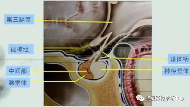 影像PPT - 垂体正常表现及垂体瘤影像诊断-1 影像PPT - 垂体正常表现及垂体瘤影像诊断-1