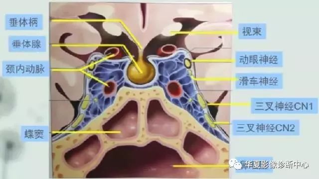 影像PPT - 垂体正常表现及垂体瘤影像诊断-2 影像PPT - 垂体正常表现及垂体瘤影像诊断-2