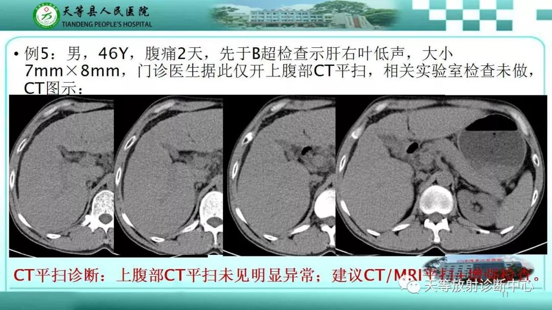 影像PPT - 【PPT】肝脏增强扫描的重要意义-11