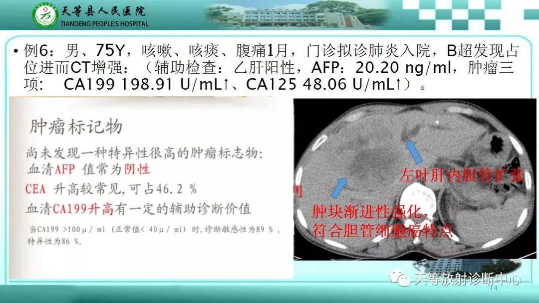 影像PPT - 【PPT】肝脏增强扫描的重要意义-14