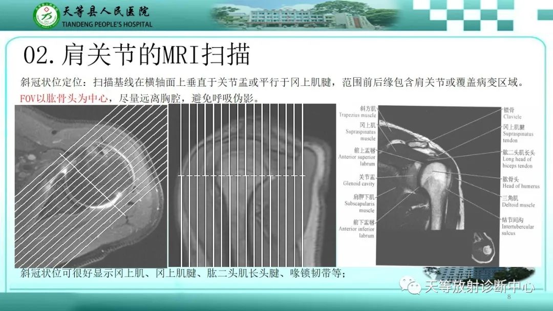影像PPT - 【PPT】肩关节MRI扫描技术-8