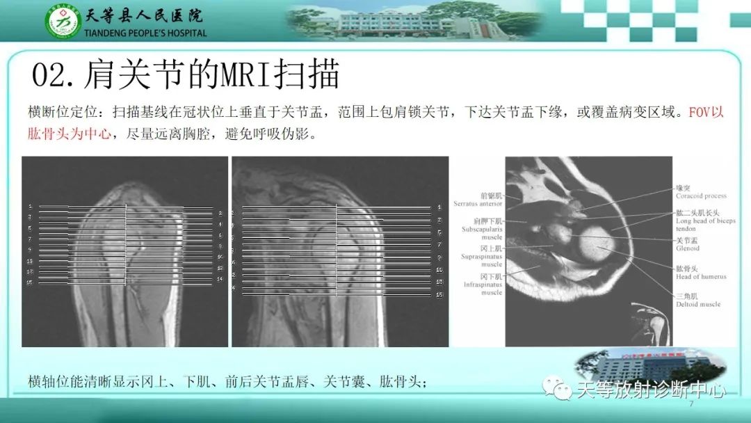 影像PPT - 【PPT】肩关节MRI扫描技术-7