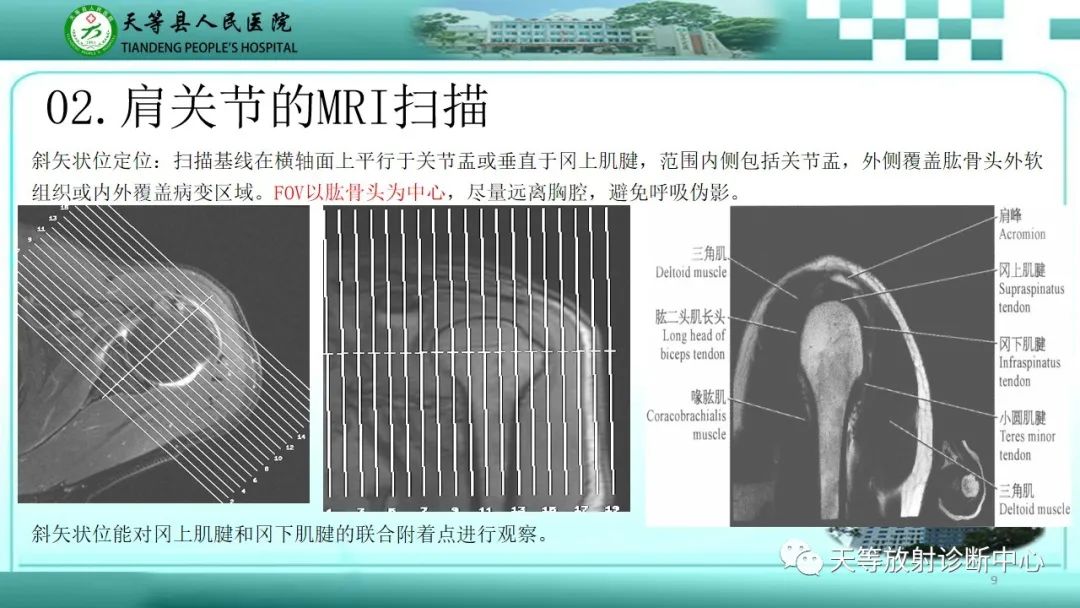 影像PPT - 【PPT】肩关节MRI扫描技术-9