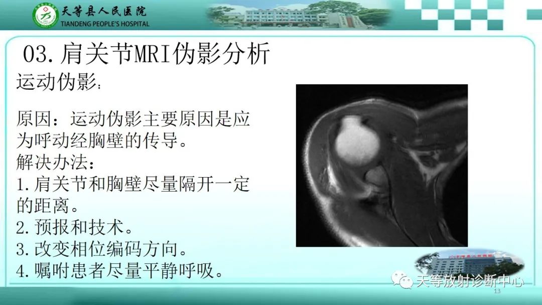 影像PPT - 【PPT】肩关节MRI扫描技术-13