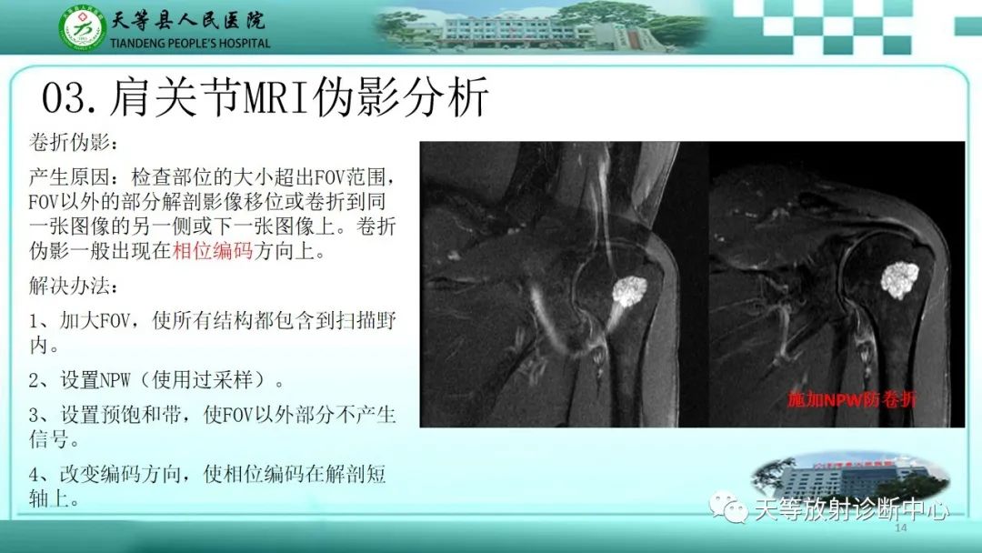 影像PPT - 【PPT】肩关节MRI扫描技术-14