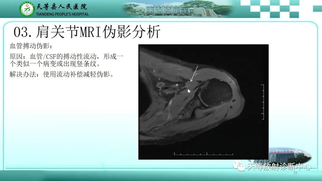 影像PPT - 【PPT】肩关节MRI扫描技术-15