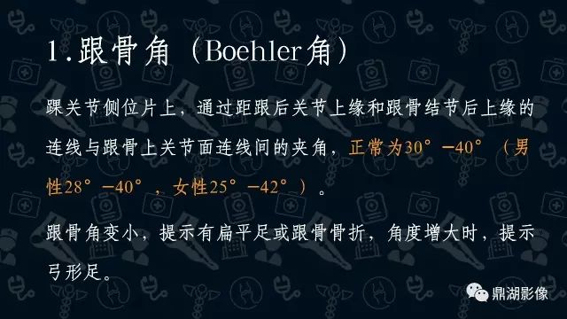 影像PPT - 扁平足X线测量方法-1 影像PPT - 扁平足X线测量方法-1