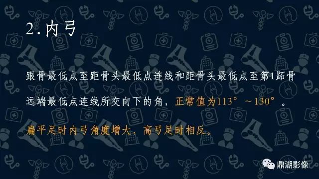 影像PPT - 扁平足X线测量方法-3 影像PPT - 扁平足X线测量方法-3