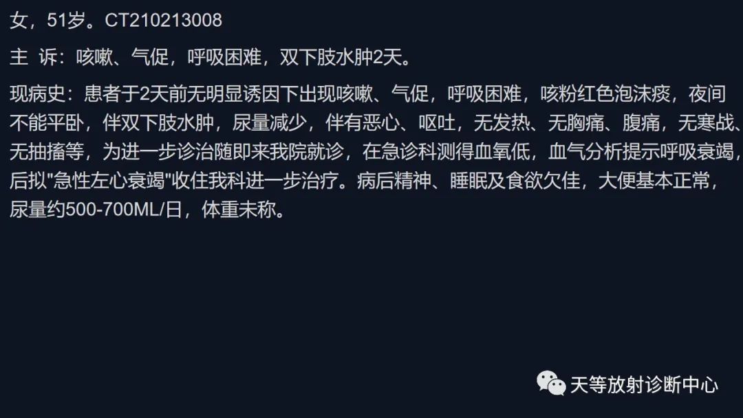 影像PPT - 【病例】ANCA相关性血管炎肺部改变-1