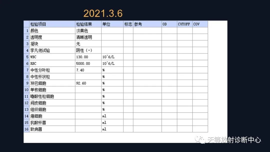 影像PPT - 【病例】ANCA相关性血管炎肺部改变-4