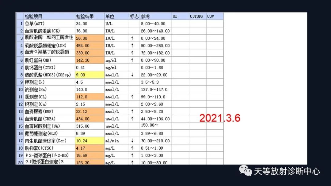 影像PPT - 【病例】ANCA相关性血管炎肺部改变-8