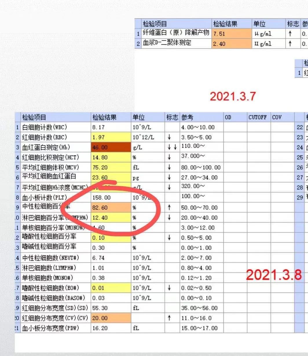 影像PPT - 【病例】ANCA相关性血管炎肺部改变-30
