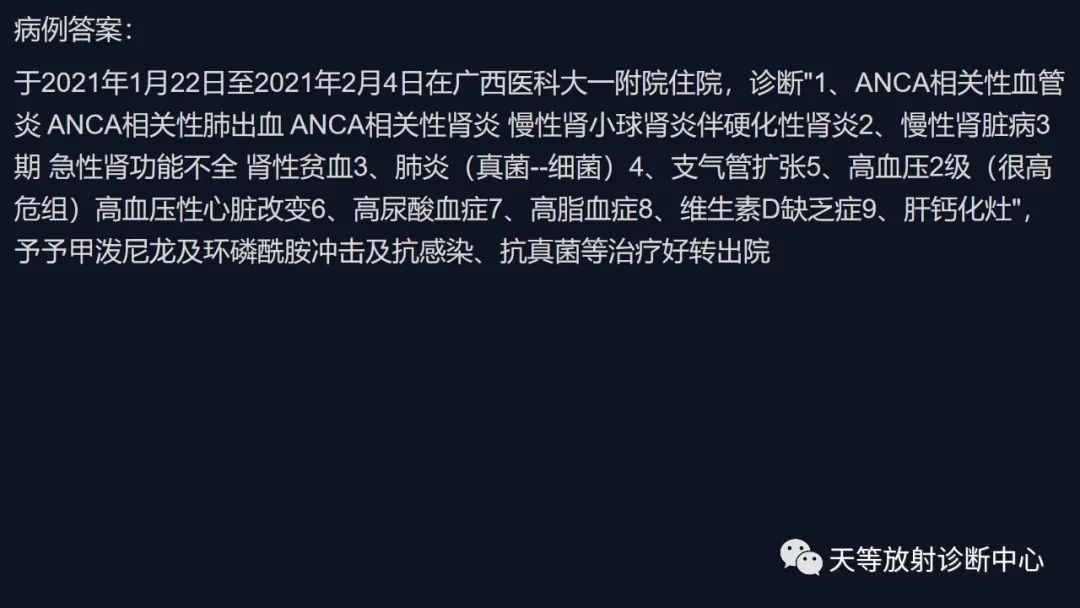 影像PPT - 【病例】ANCA相关性血管炎肺部改变-37