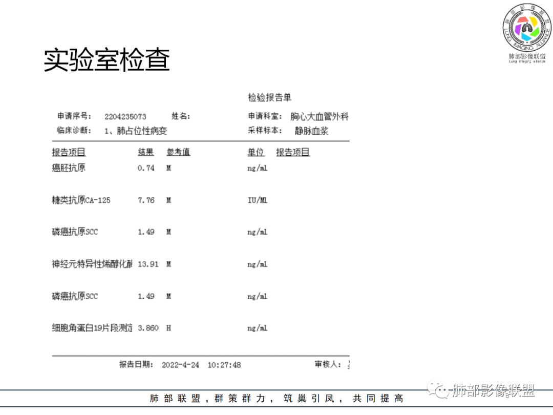 影像PPT - 【病例】硬化性肺泡细胞瘤PSP一例CT-3 影像PPT - 【病例】硬化性肺泡细胞瘤PSP一例CT-3