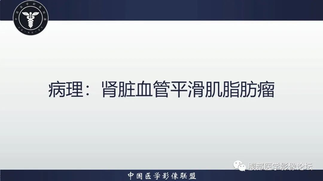 影像PPT - 【病例】肾脏血管平滑肌脂肪瘤1例CT影像-8