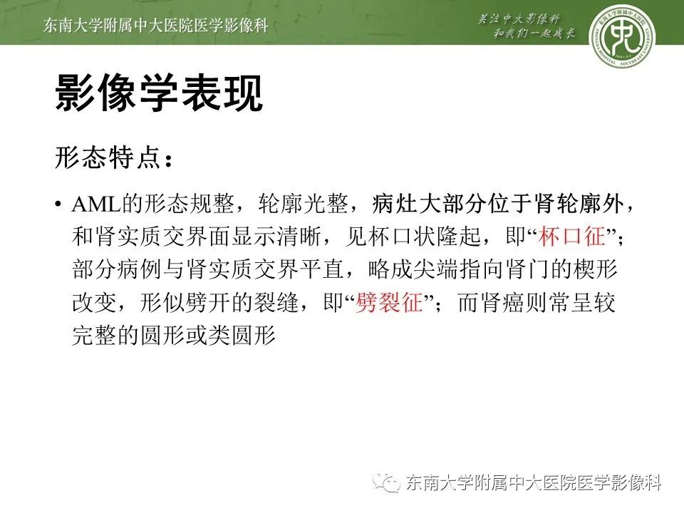 影像PPT - 【病例】肾脏血管平滑肌脂肪瘤1例CT影像-12