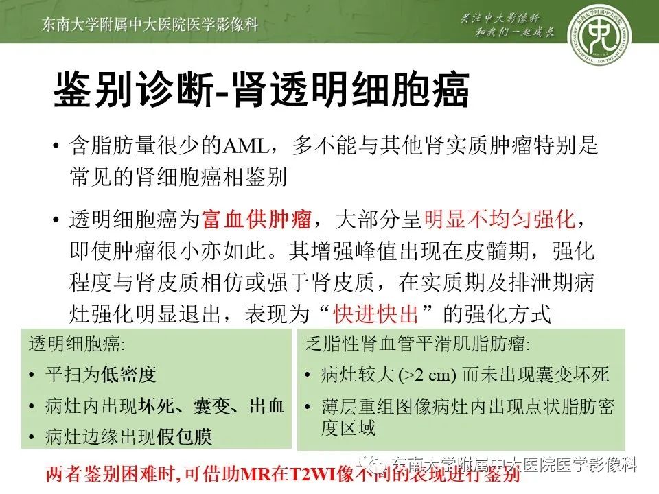 影像PPT - 【病例】肾脏血管平滑肌脂肪瘤1例CT影像-18