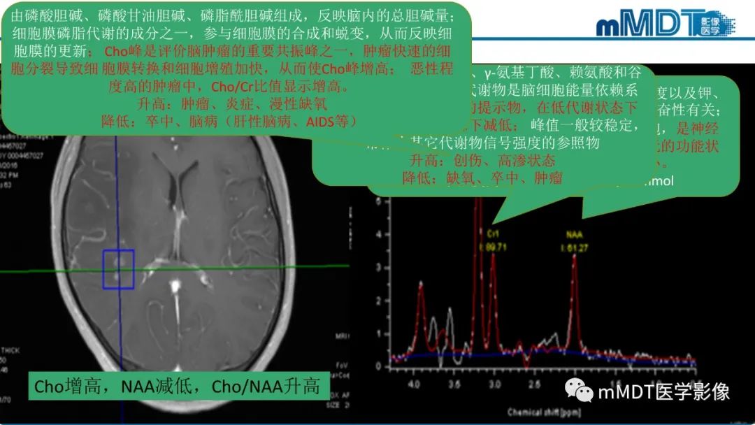 影像PPT - 【PPT】星形细胞瘤的新认识-6