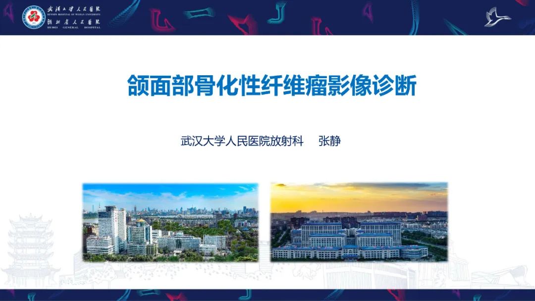 影像PPT - 【PPT】颌面部骨化性纤维瘤影像诊断-1