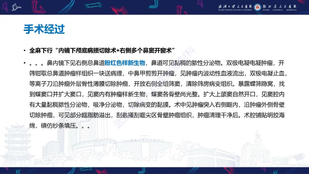 影像PPT - 【PPT】颌面部骨化性纤维瘤影像诊断-5