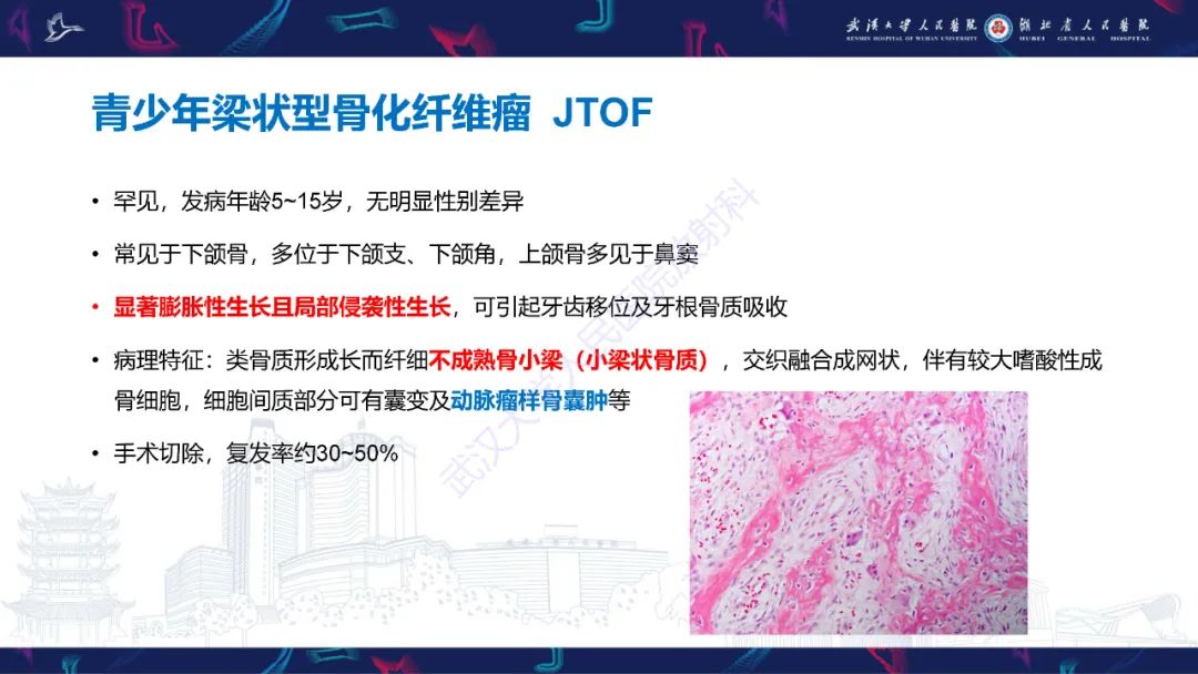 影像PPT - 【PPT】颌面部骨化性纤维瘤影像诊断-16