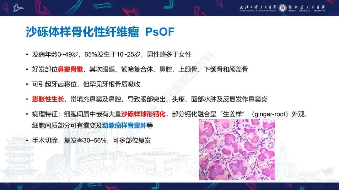 影像PPT - 【PPT】颌面部骨化性纤维瘤影像诊断-19