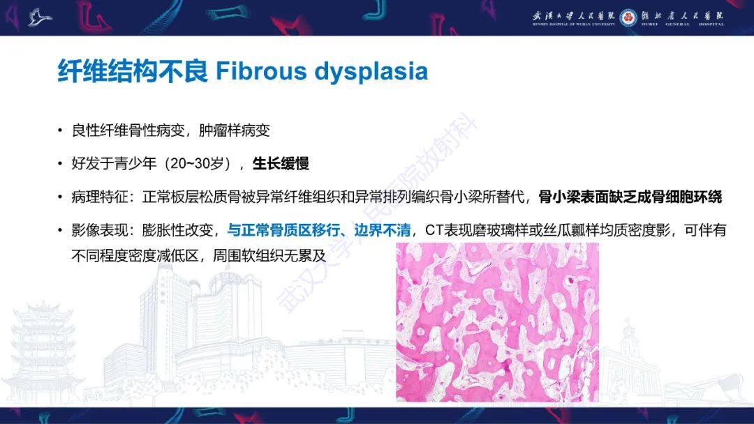影像PPT - 【PPT】颌面部骨化性纤维瘤影像诊断-26