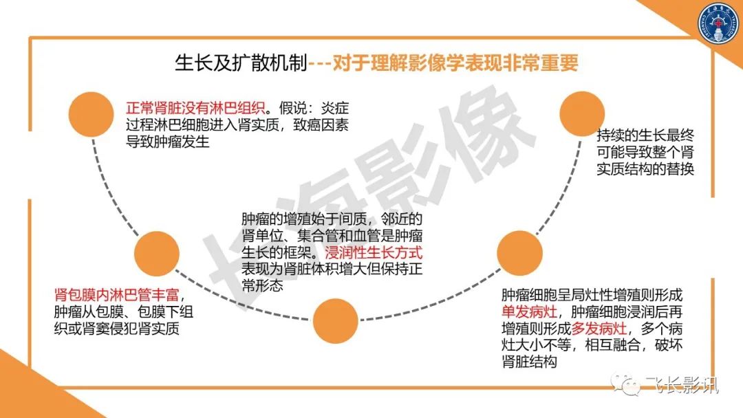 影像PPT - 【PPT】原发性肾淋巴瘤的影像诊断-8