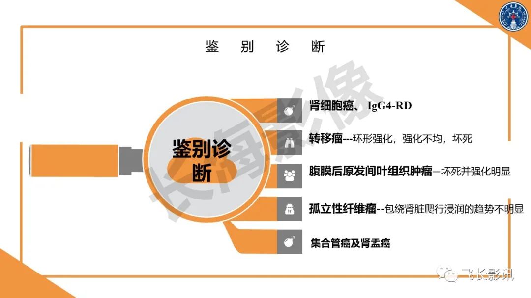 影像PPT - 【PPT】原发性肾淋巴瘤的影像诊断-25