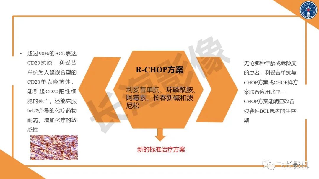 影像PPT - 【PPT】原发性肾淋巴瘤的影像诊断-30