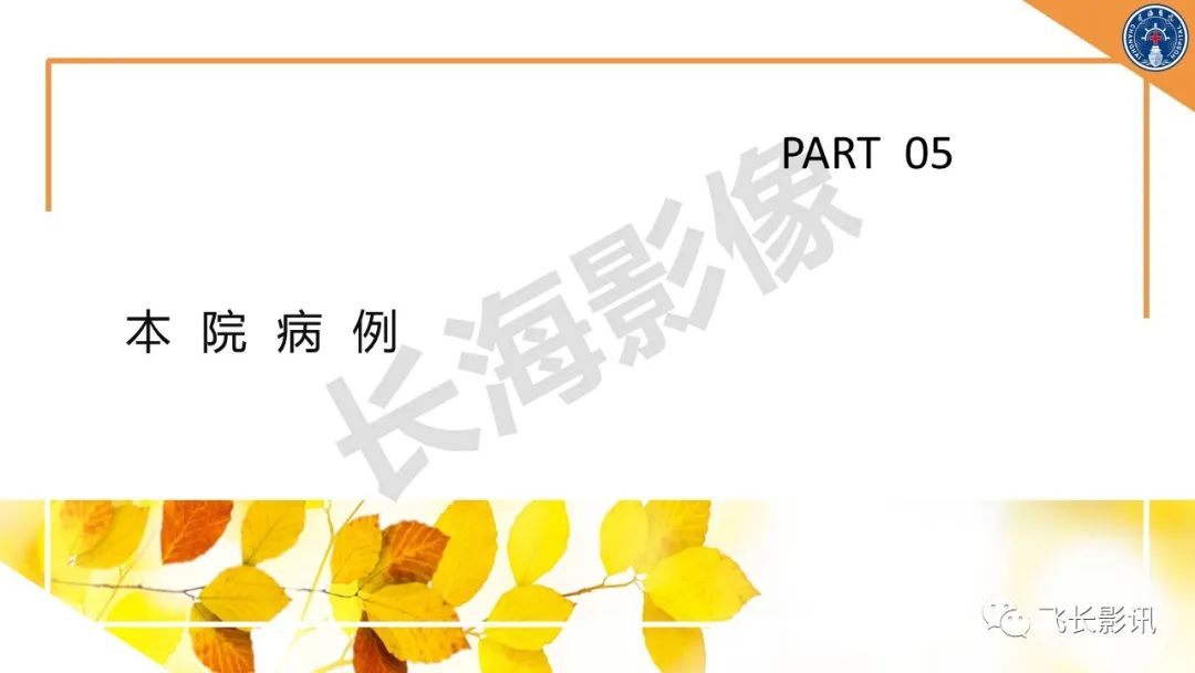 影像PPT - 【PPT】原发性肾淋巴瘤的影像诊断-31