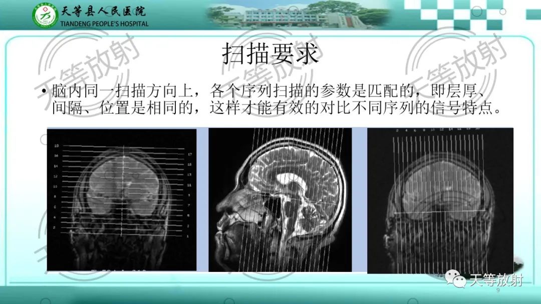 影像PPT - 【PPT】颅内感染疾病磁共振扫描及影像表现-9