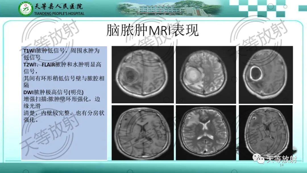 影像PPT - 【PPT】颅内感染疾病磁共振扫描及影像表现-14