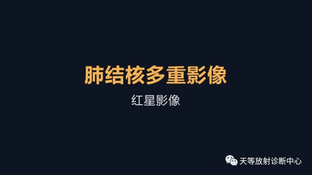 影像PPT - 【病例】肺结核1例CT影像征象分析-1 影像PPT - 【病例】肺结核1例CT影像征象分析-1