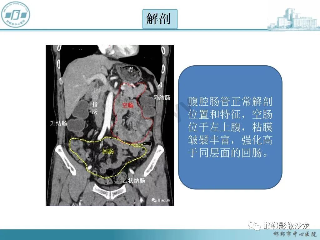 影像PPT - 【PPT】中肠旋转不良-10