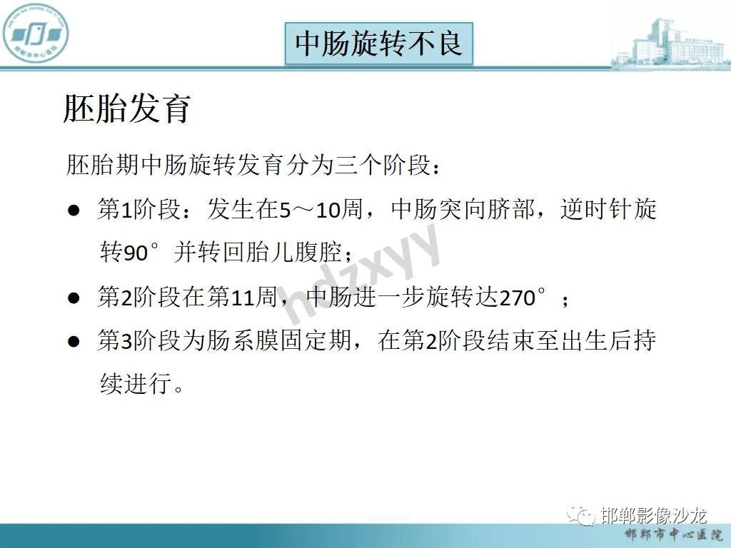 影像PPT - 【PPT】中肠旋转不良-11